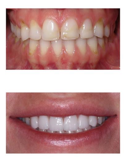 The Smile Centre – Venice - General dentist in Venice, FL