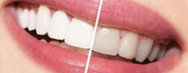 Brantly Dental - General dentist in San Angelo, TX