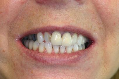 Dr. Rodica Iancu – Cosmetic and General Dentistry - Cosmetic dentist in Mequon, WI