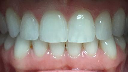 Dr. Jennifer Young, DDS - General dentist in Clarksville, AR