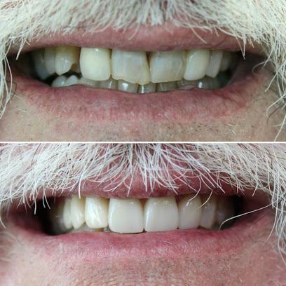 Premier General & Cosmetic Dentistry - General dentist in Wellington, FL