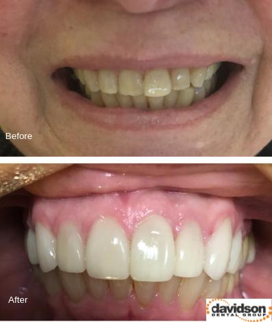 Davidson Dental Group - General dentist in San Leandro, CA