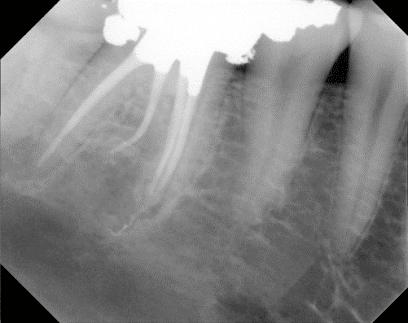 Carson City Endodontics - Endodontist in Carson City, NV