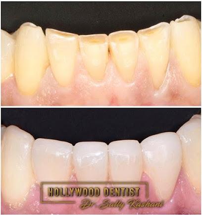 Dr. Sally Kashani – Hollywood Dentist - General dentist in North Hollywood, CA