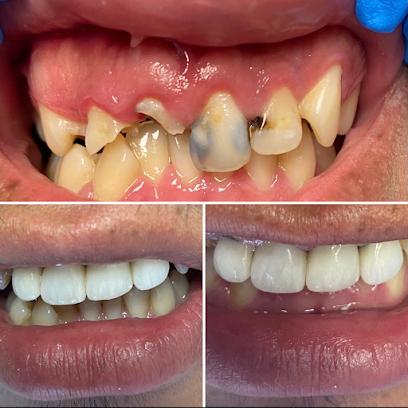 We Care Dental - General dentist in Oceanside, CA
