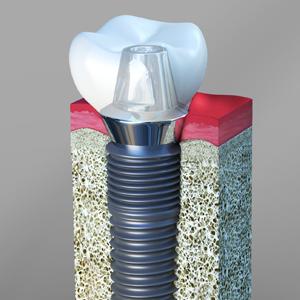 Andrew R. Rahn DDS, PC - Oral surgeon in Fresno, CA