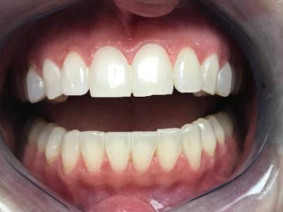 Carey Family Dentistry LLC - General dentist in Old Bridge, NJ