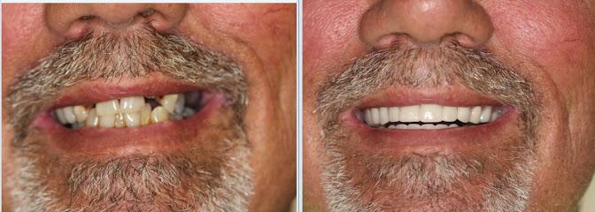 Dentures & Dental Implants by Dr. Kasem - General dentist in Ocoee, FL