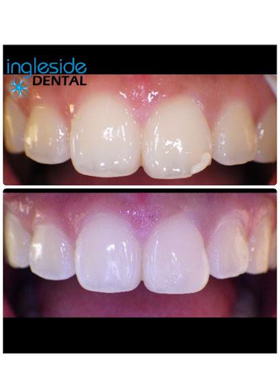Ingleside Dental SF - General dentist in San Francisco, CA