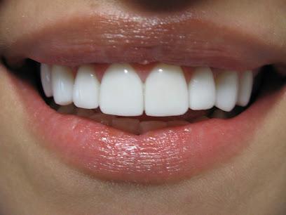 Preferred Dental Care - General dentist in San Rafael, CA