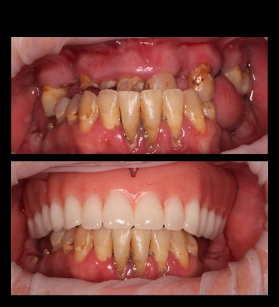 Prime Dentistry - General dentist in The Villages, FL