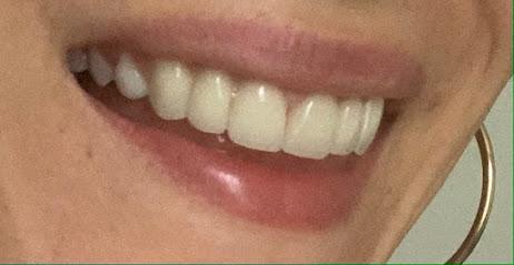 Stewart Elizabeth DDS - General dentist in Winchester, IN