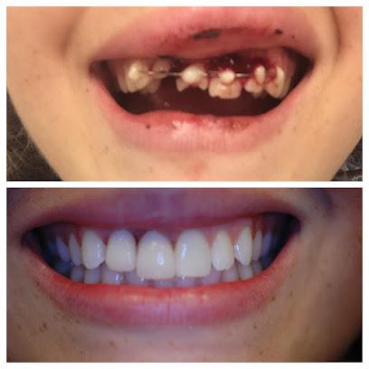 Grantline Dental - General dentist in Tracy, CA