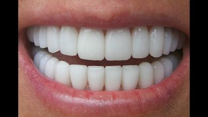Arlington Dental Team - Cosmetic dentist in Arlington, VA