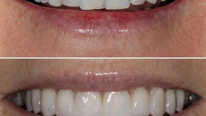 Andrew Turchin, DMD - Cosmetic dentist in Aspen, CO