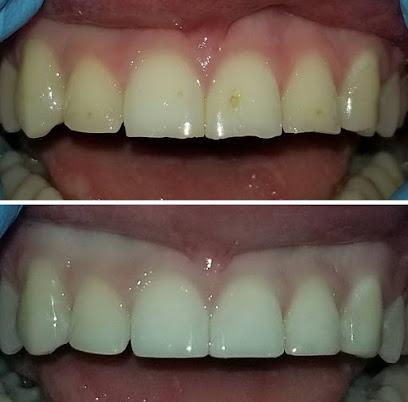 Melgosa Dental Turlock - General dentist in Turlock, CA