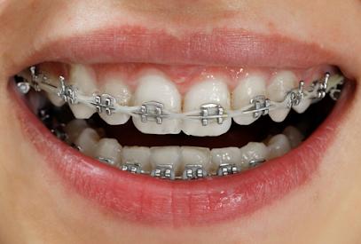 Beach Smile Dental - General dentist in Redondo Beach, CA