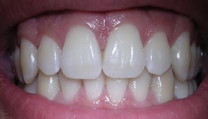 Lehigh Valley Sculpted Smiles: Michael E. Kun, DMD - General dentist in Whitehall, PA