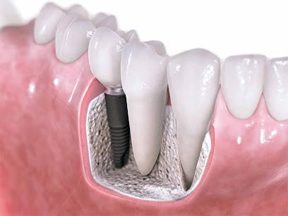 E Dental - General dentist in Seminole, FL