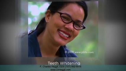 F. Charles Heggli, DDS - General dentist in Petaluma, CA