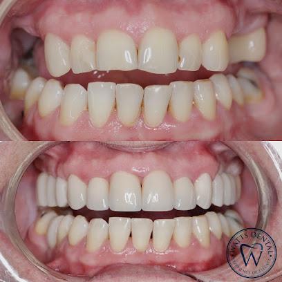Watts Dental - General dentist in Lithia, FL