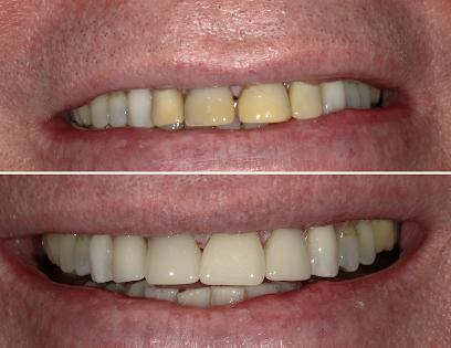 iSmile Pearce - General dentist in Pearce, AZ