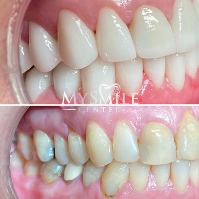 My Smile Center - General dentist in Miami, FL