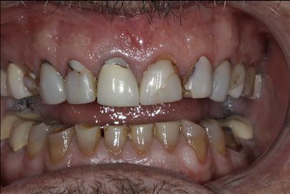 Pure Dental of Camarillo| Janna Gorinstein DDS - General dentist in Camarillo, CA