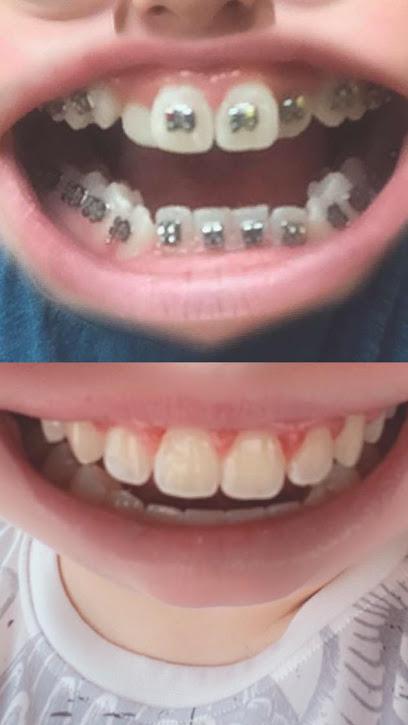 Orthodontic Specialists - Orthodontist in Florence, KY