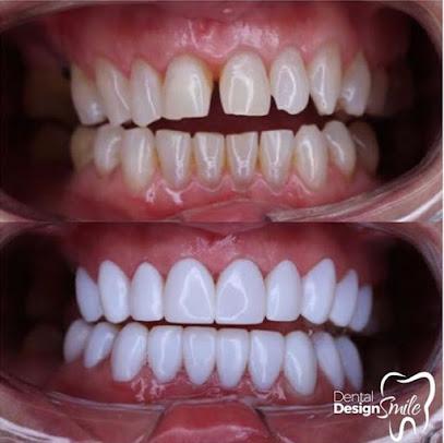 Dental Design Smile - General dentist in Miami, FL