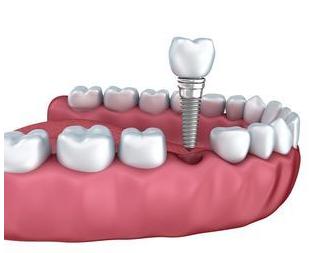 Robert Rapisarda, DMD - Cosmetic dentist in Three Rivers, MA
