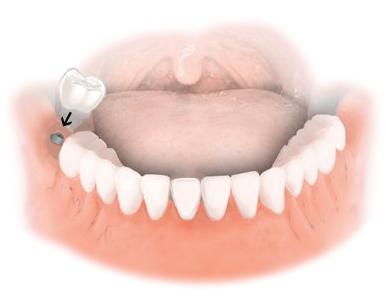 Dentist - Cosmetic dentist in Cincinnati, OH