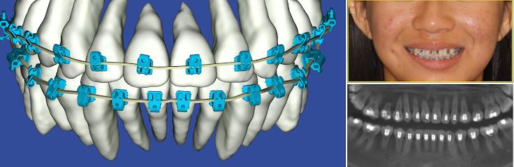 Scissortail Orthodontics - Orthodontist in Stillwater, OK