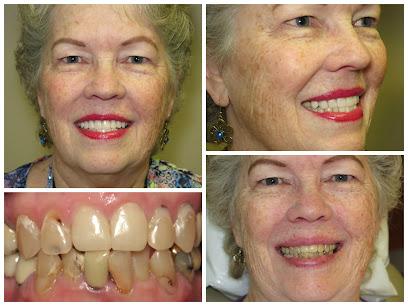 Pomerado Family Dental – Sarju B. Patel, DDS – Poway Dentist - General dentist in Poway, CA