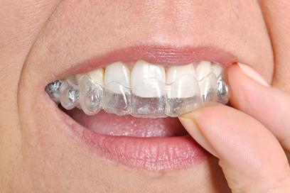 Michael E. Simony, D.D.S - General dentist in Clinton Township, MI