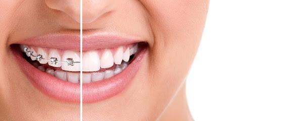 Miami Beach Orthodontics - Orthodontist in Miami Beach, FL