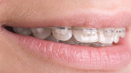 William M. Shows DMD - Orthodontist in Sheboygan, WI