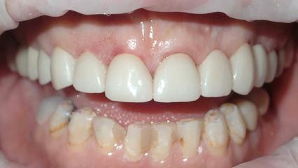 Arlington Comfort Dental - General dentist in Arlington Heights, IL