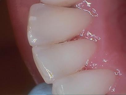 Biologic Dentistry - Cosmetic dentist in Acworth, GA