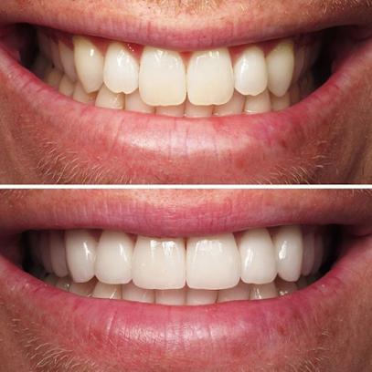 Kevin B. Sands, DDS – Cosmetic Dentistry Beverly Hills - Cosmetic dentist, General dentist in Beverly Hills, CA