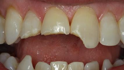 Longboat Key Dental – Dr. Michael J. O’Neil DDS - General dentist in Longboat Key, FL