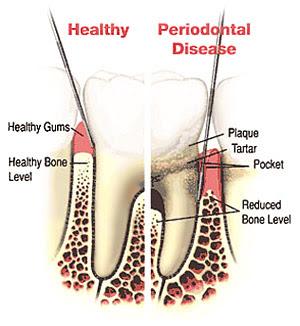 Calvert Smiles - General dentist in Dunkirk, MD