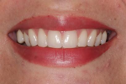 Ryan Candelora, DDS & Charles Kim, DDS – Glendale Dentist - Cosmetic dentist, General dentist in Glendale, CA