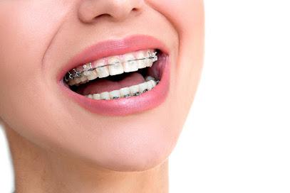 Belmont Smiles - Orthodontist in Belmont, MA