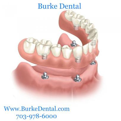 Burke Dental - General dentist in Burke, VA