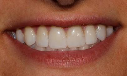Lone Oak Dental - General dentist in Brookings, SD