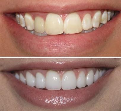 Platinum Dental of North Logan - General dentist in Logan, UT