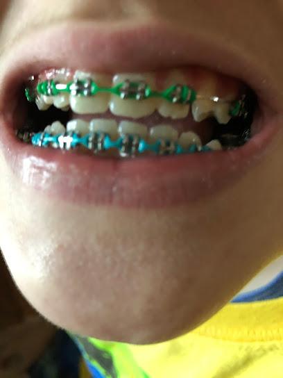Albany Braces - Orthodontist in Latham, NY
