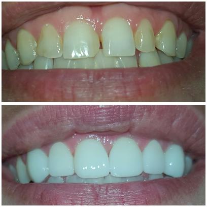 Ace Dental Center - General dentist in Hoffman Estates, IL