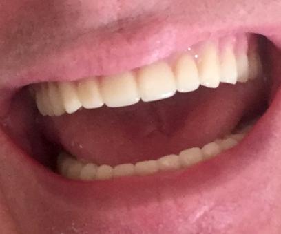 Advanced Prosthodontics - General dentist in Bethlehem, PA